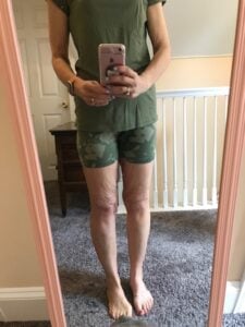 What to Take with Ozempic to Lose Weight: A Comprehensive Guide