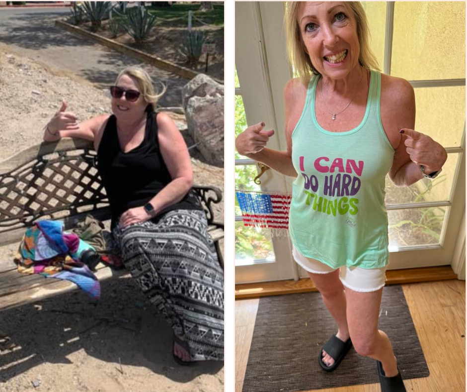 Terry before and after pictures