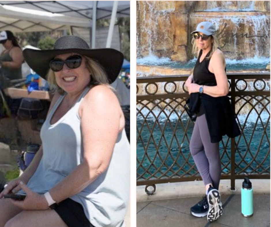 Terry before and after pictures